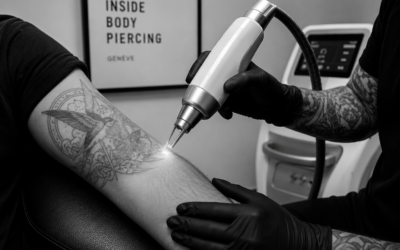 Laser tattoo removal: how to erase or fade a tattoo?